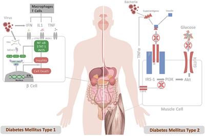 The role of pathogens in diabetes pathogenesis and the potential of immunoproteomics as a diagnostic and prognostic tool